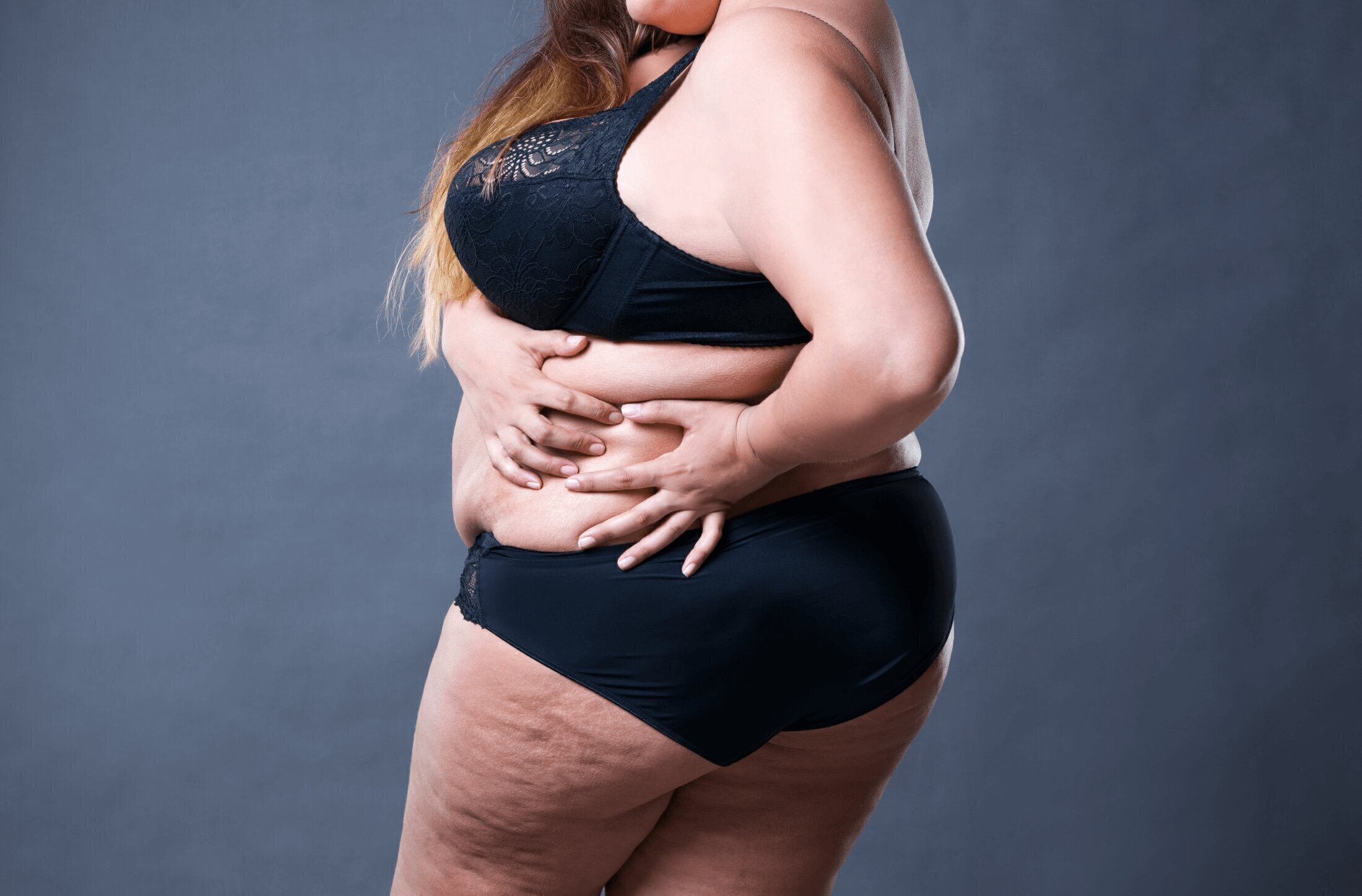 I Am Overweight. Can I Still Have A Brazilian Butt Lift? | Austin-Weston