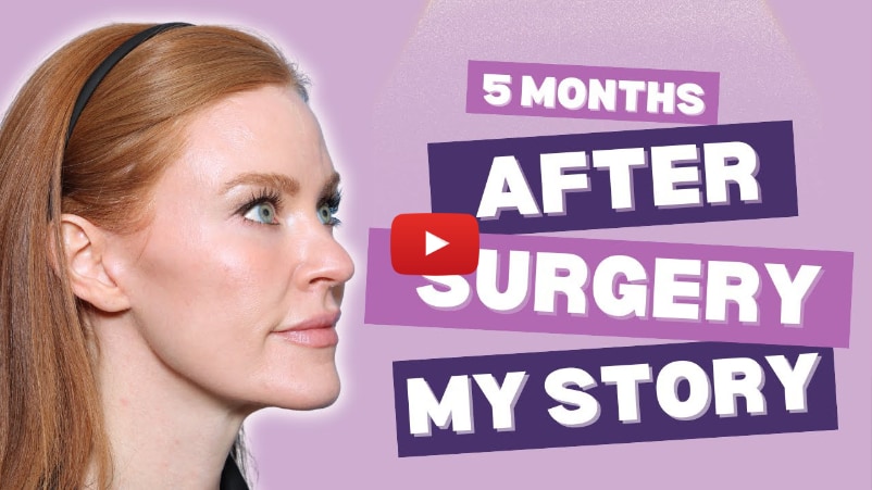 My Plastic Surgery Journey (Facelift, Neck Lift, Tummy Tuck)