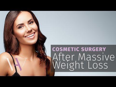 Plastic Surgery Videos  Reston